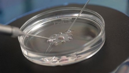Nové metody v oblasti asistované reprodukce